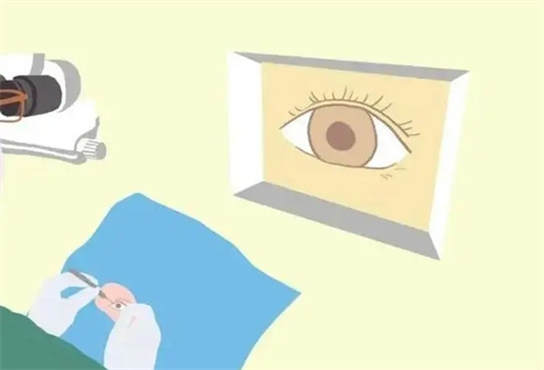 全飞秒操作动画